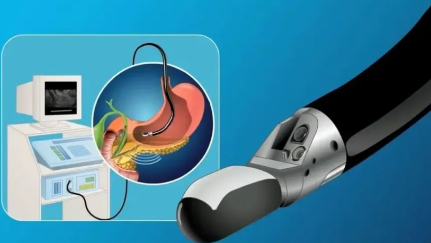 EUS (Endoskopik Ultrasonografi)